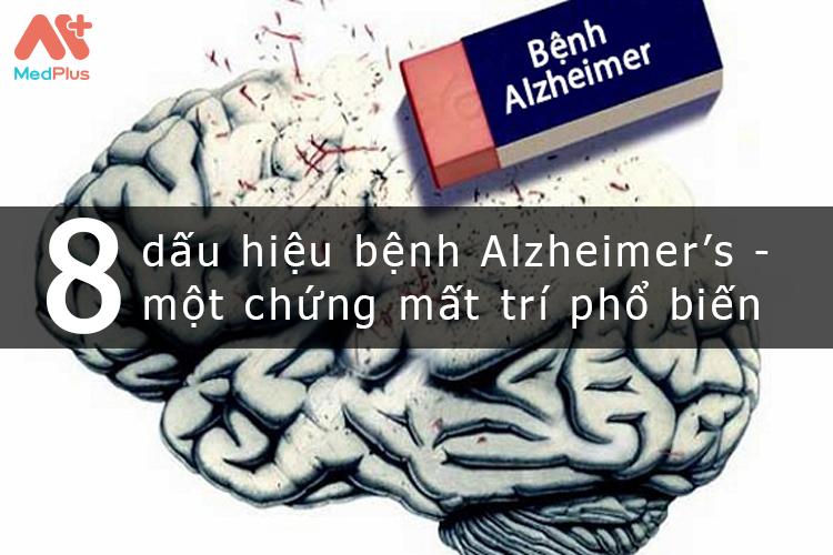 8 dấu hiệu bệnh Alzheimer's