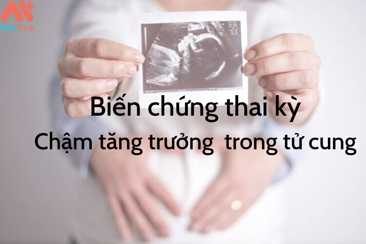 Biến chứng thai kỳ- chậm tăng trưởng trong bụng mẹ