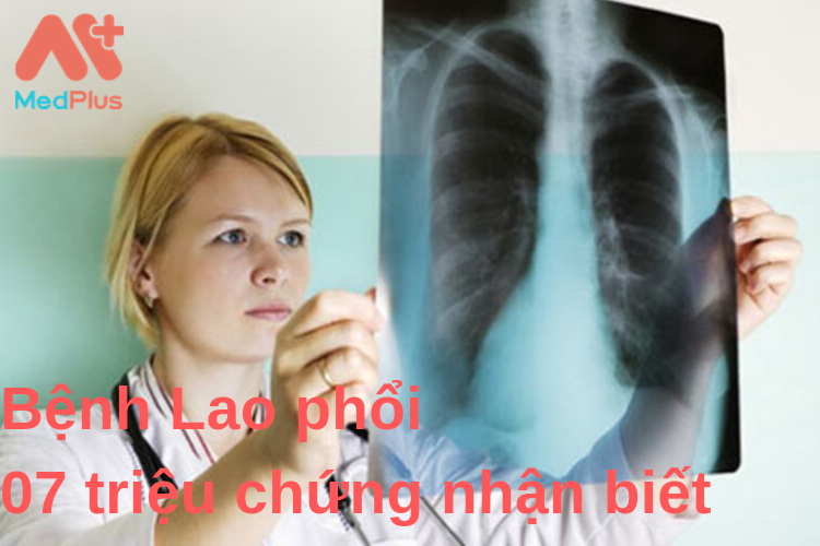 Bệnh Lao Phổi Và 07 Triệu Chứng Nhận Biết 4 Bệnh Lao phổi 07 triệu chứng nhận biết - Medplus