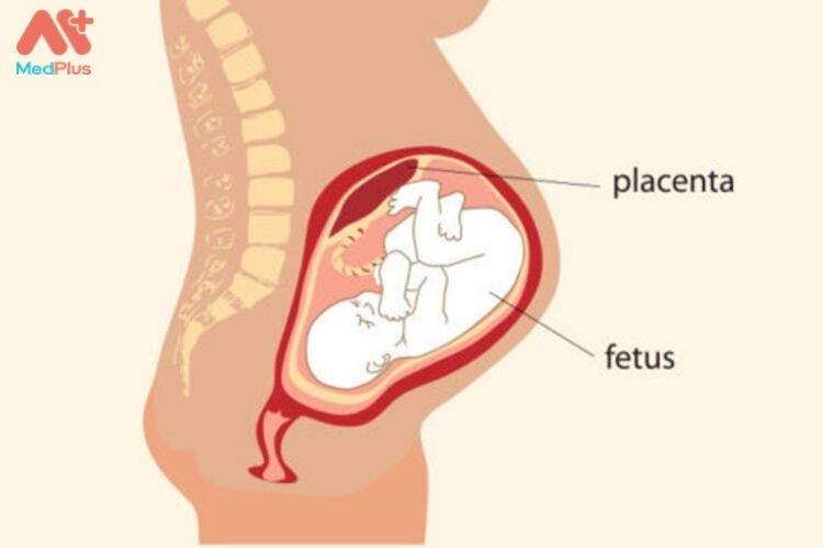 Biến chứng thai kỳ Bong nhau thai 2 - Medplus