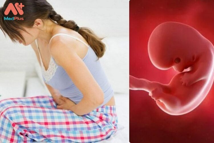 Biến chứng thai kỳ Thai chết lưu 2 - Medplus