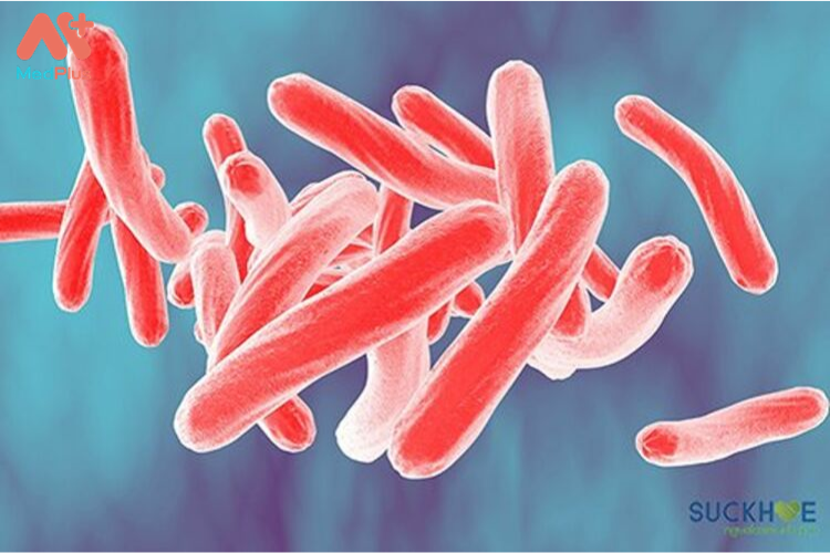 Vi khuẩn MTB là một trong những nguyên nhân gây ra bệnh leo phổi