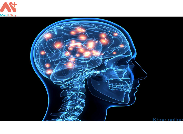 Các ổ áp xe não gây ảnh hưởng xấu lên các dây thần kinh.