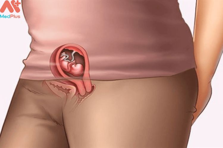 Cơ thể phát triển gần như hoàn thiện của thai nhi tuần 8 