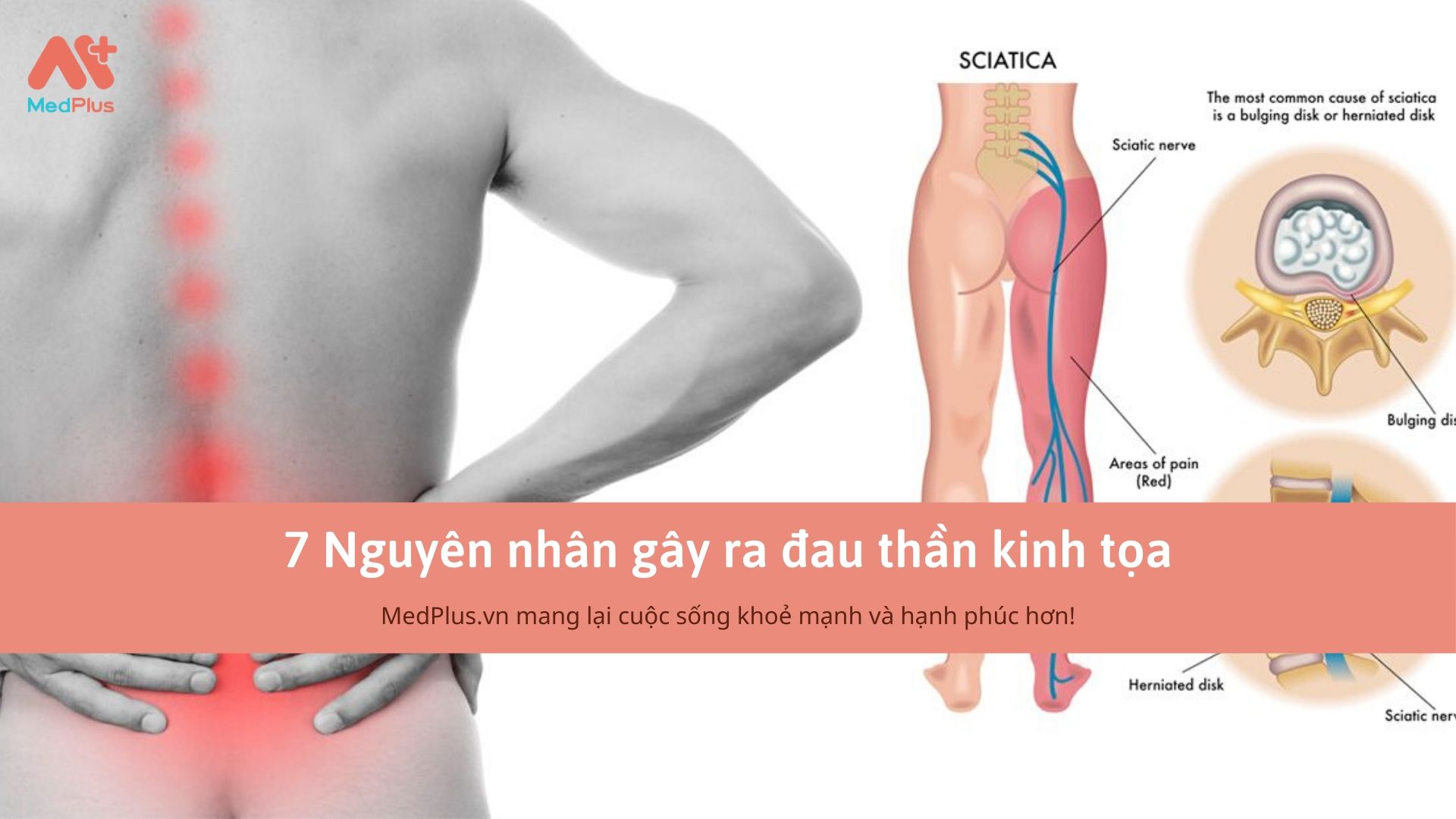 7 nguyên nhân gây bệnh