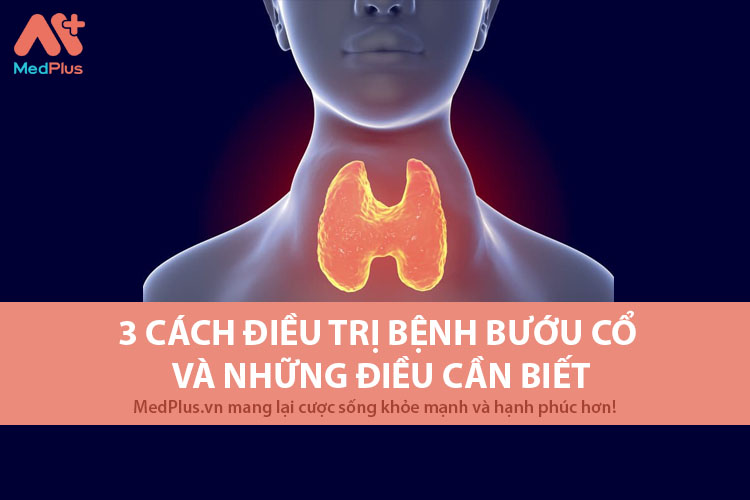 3 cách điều trị bệnh bướu cổ và những điều cần biết