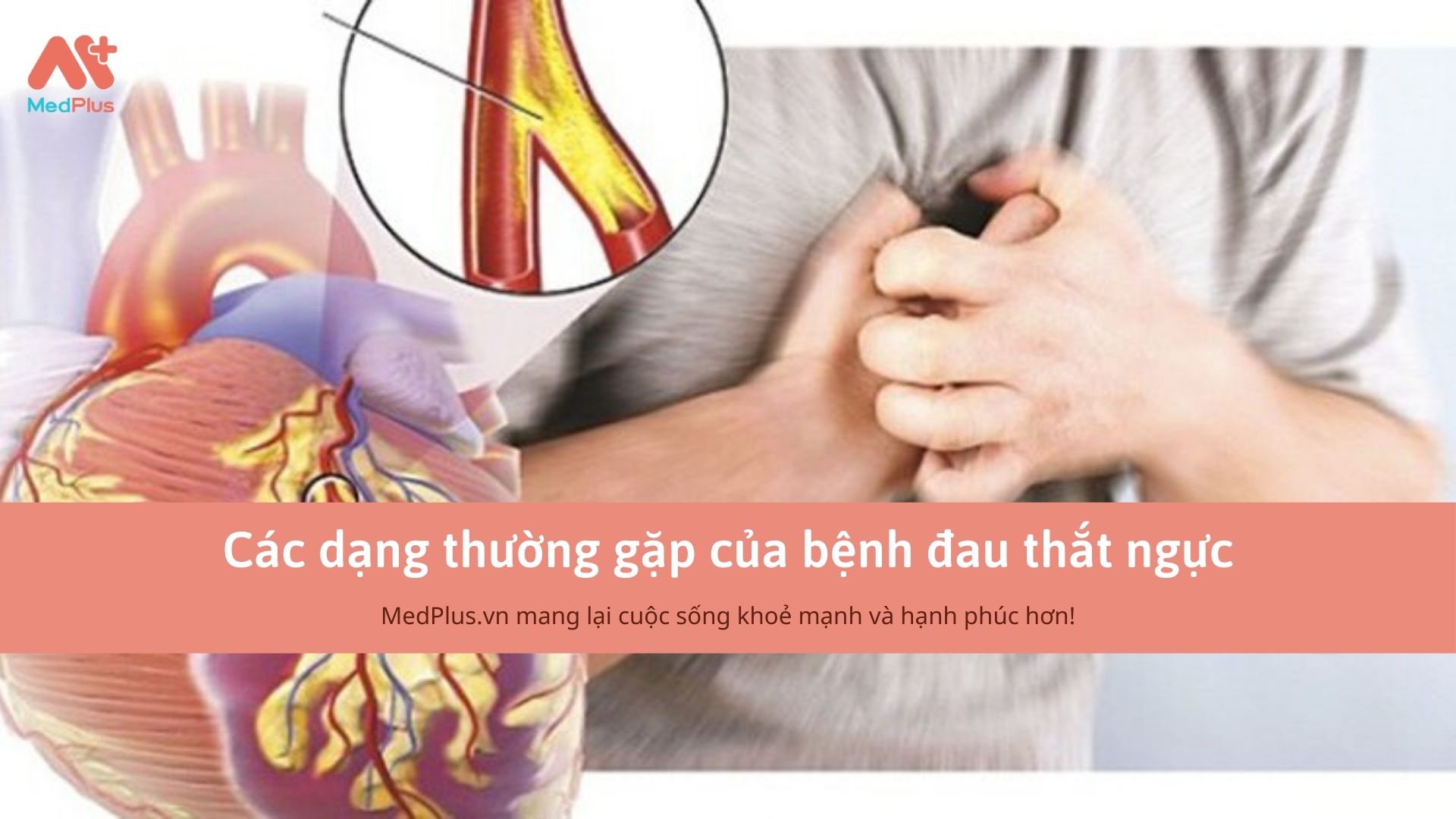 Các dạng thường gặp của bệnh