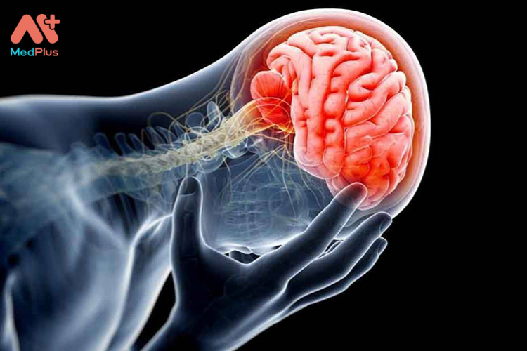 Chấn thương sọ não là bị chấn thương vùng đầu
