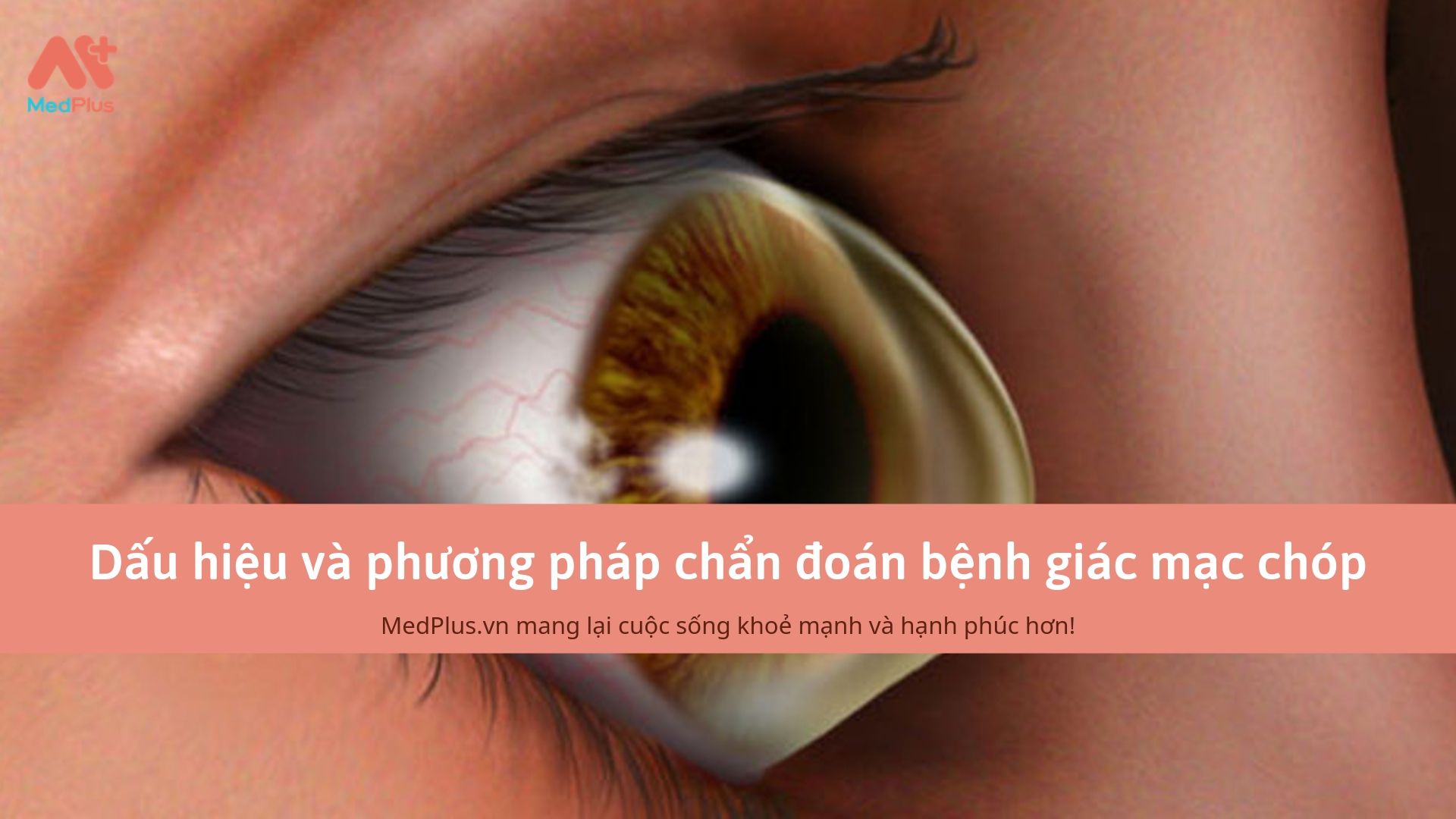 Dấu hiệu và phương pháp chẩn đoán bệnh