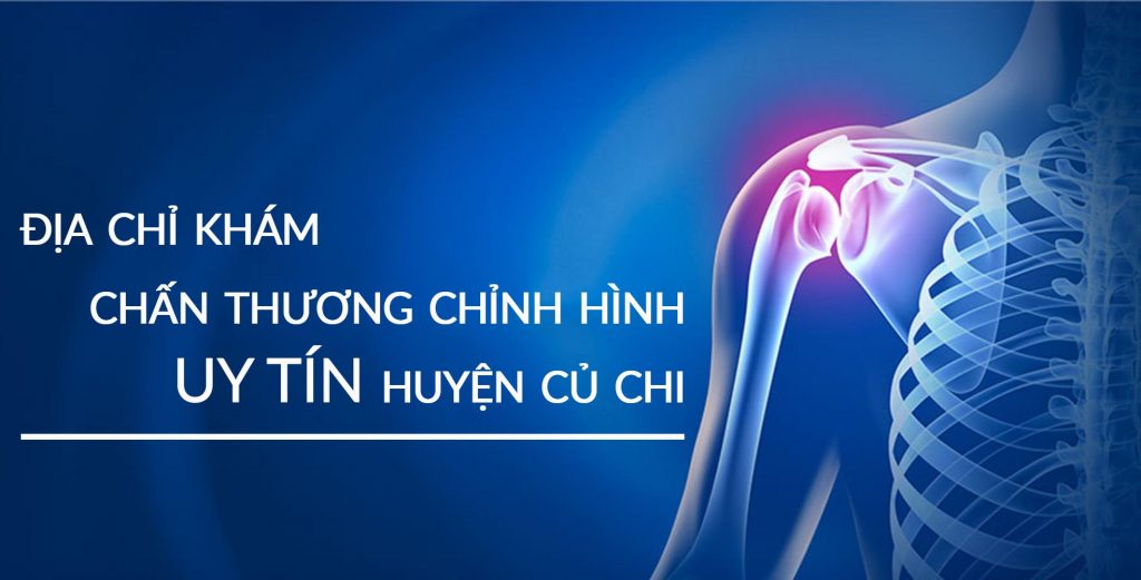 Danh sách 3 địa chỉ khám Chấn thương chỉnh hình uy tín huyện Củ Chi