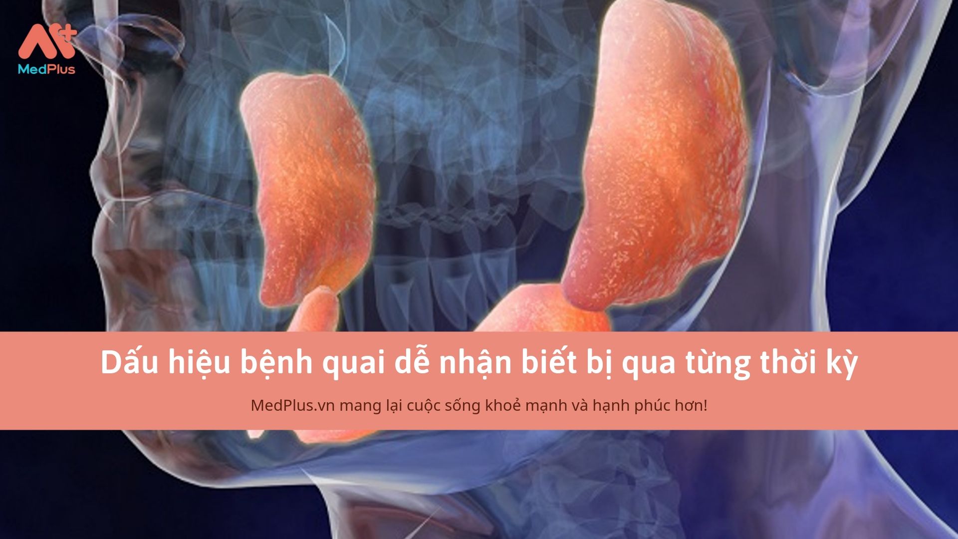 Dấu hiệu bệnh quai dễ nhận biết bị qua từng thời kỳ