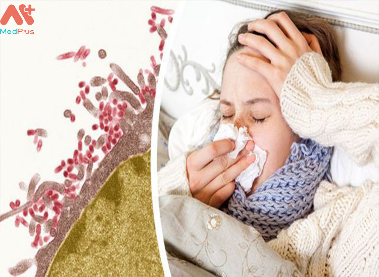 Vi khuẩn tấn công làm người bệnh sôt, ớn lạnh ở giai đoạn đầu của cúm.