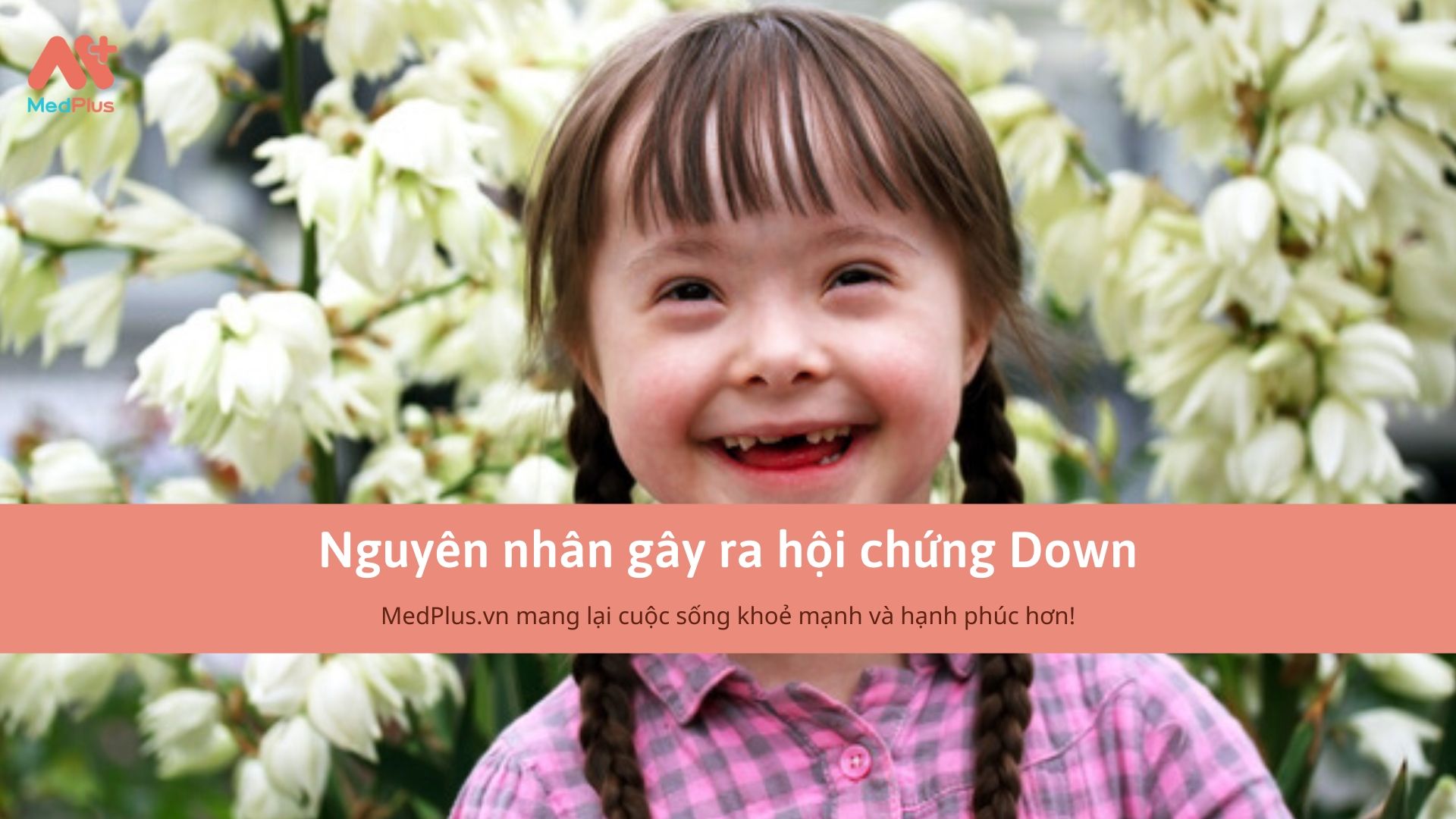 Nguyên nhân gây ra hội chứng Down