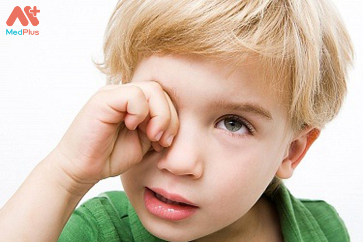 Không dụi mắt vì dụi mắt có thể gây tổn thương giác mạc