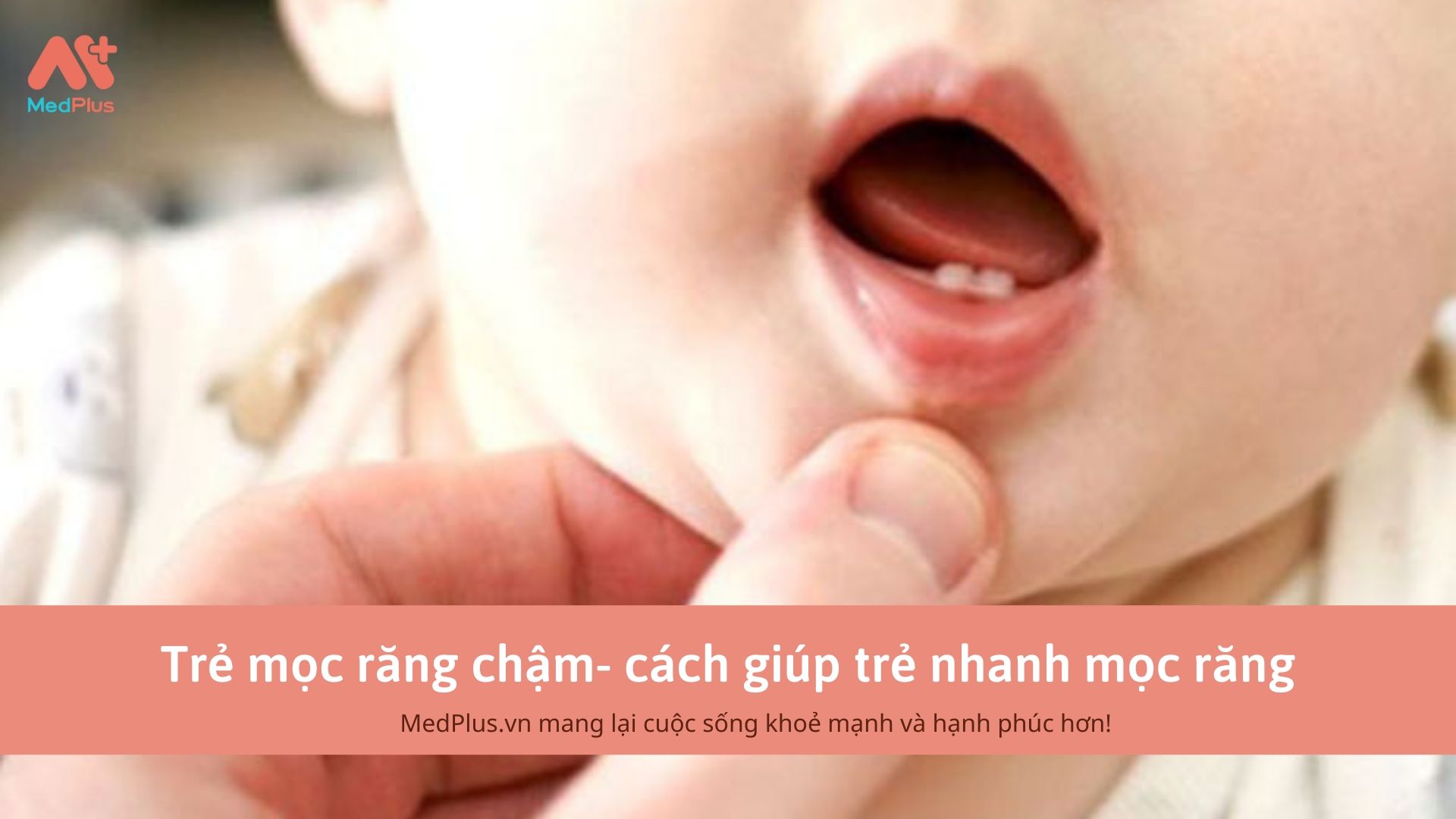 Trẻ mọc răng chậm- cách giúp trẻ nhanh mọc răng