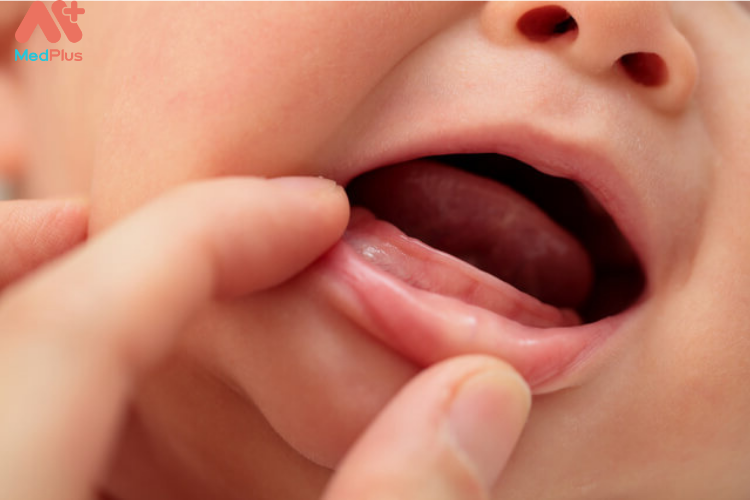 Cách giải quyết khi trẻ mọc răng chậm
