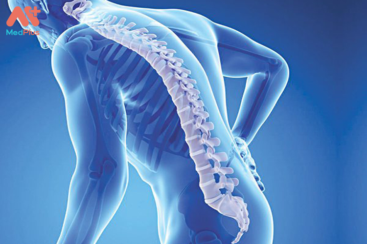 Các triệu chứng lao xương khớp thường gặp 131 Bệnh lao xương cột sống