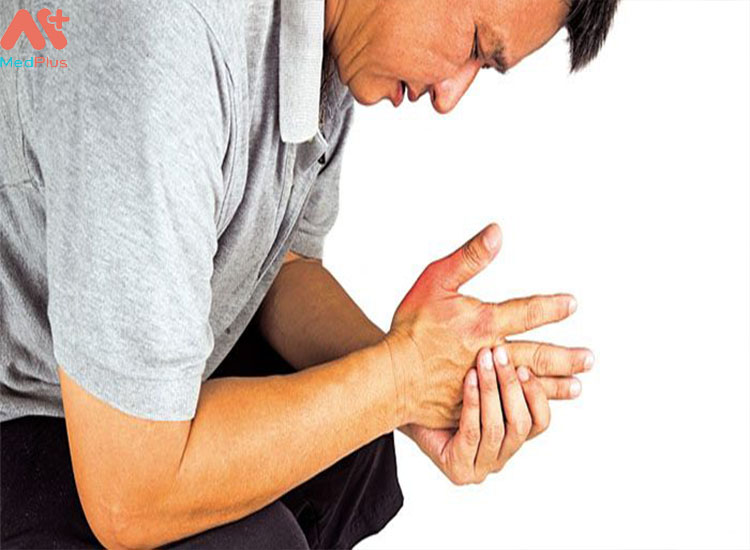 Bệnh gout cũng là một trong những nguyên nhân gây đau dây thần kinh chẩm.