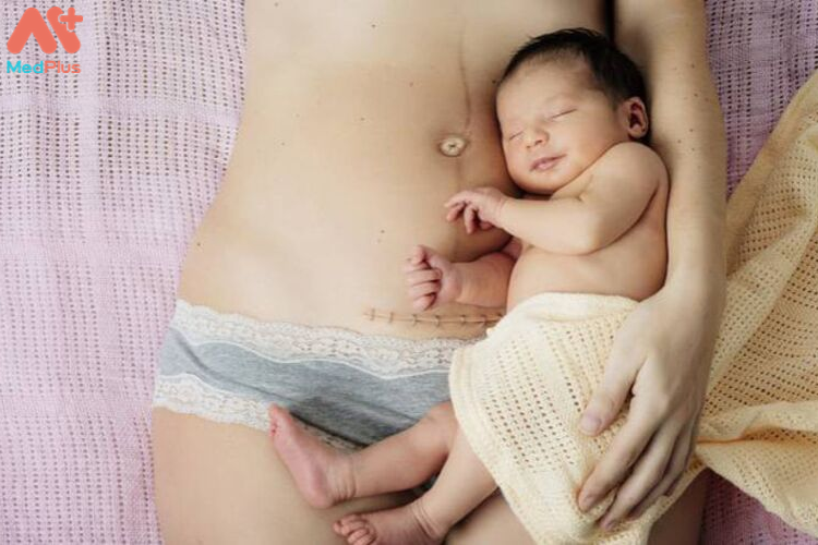 Sinh con bằng phương pháp mổ - nguyên nhân do đâu? 132 Nguyên nhân sinh mổ