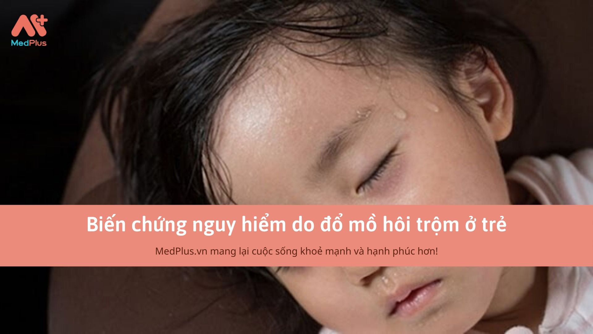 Biến chứng nguy hiểm do đổ mồ hôi trộm ở trẻ