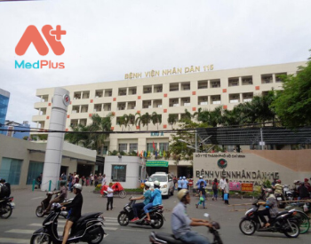Bệnh viện Nhân Dân 115 là nơi khám bướu cổ hàng đầu TPHCM