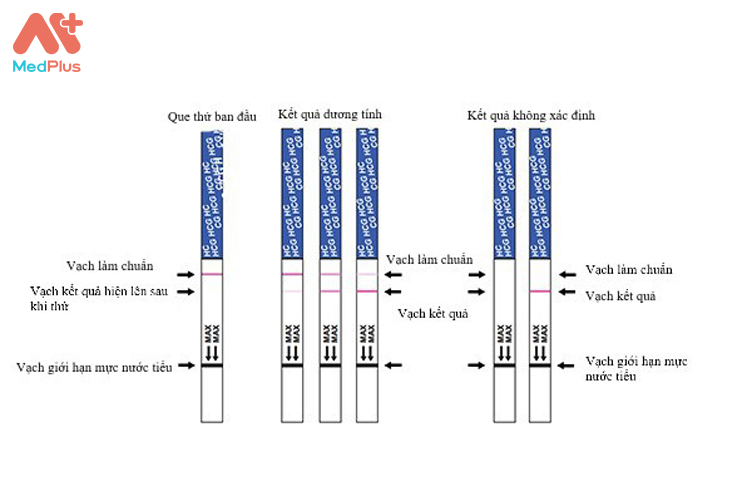 Cách đọc kết quả que thử thai