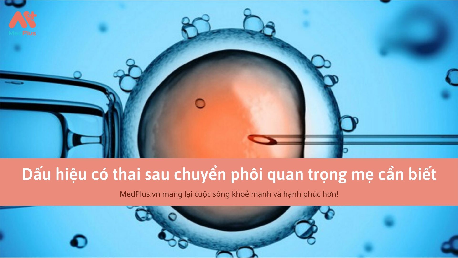 Dấu hiệu có thai sau chuyển phôi quan trọng mẹ cần biết