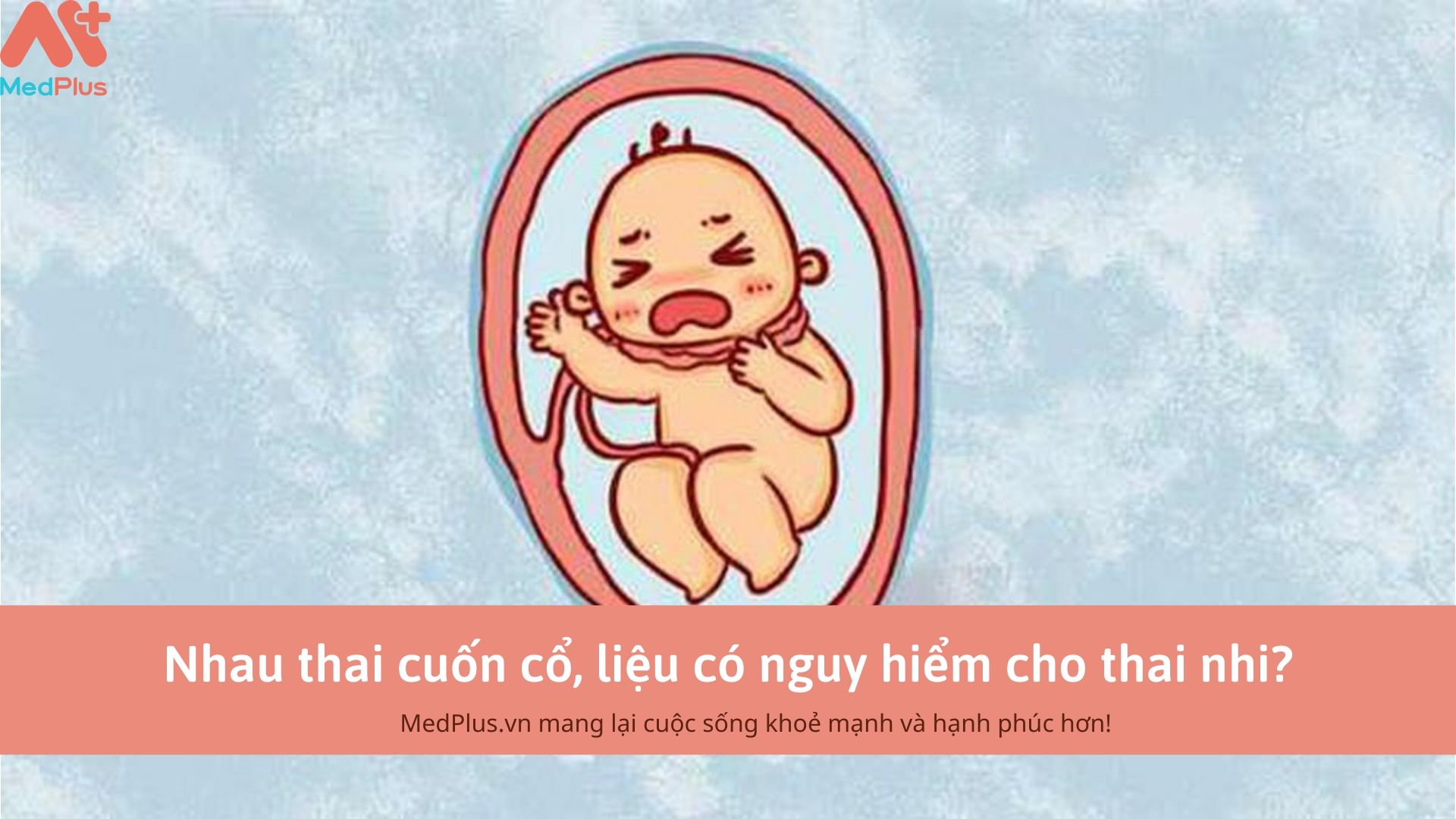 Nhau thai cuốn cổ, liệu có nguy hiểm cho thai nhi? 129 Nhau thai cuốn cổ, liệu có nguy hiểm cho thai nhi?