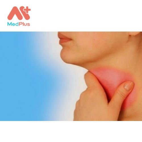 Bật mí 5 địa chỉ trị Viêm họng uy tín Quận 8 135 Bật mí 5 địa chỉ trị Viêm họng uy tín Quận 8