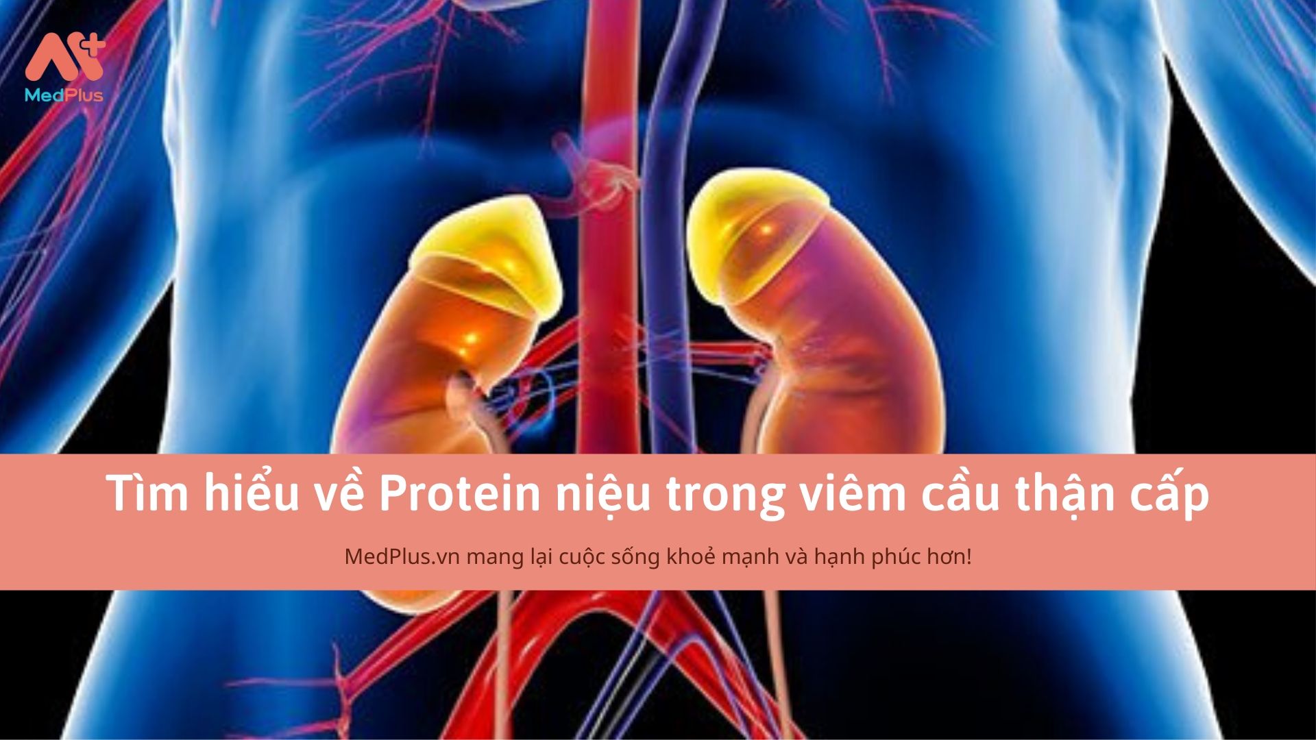 Tìm hiểu về Protein niệu trong viêm cầu thận cấp