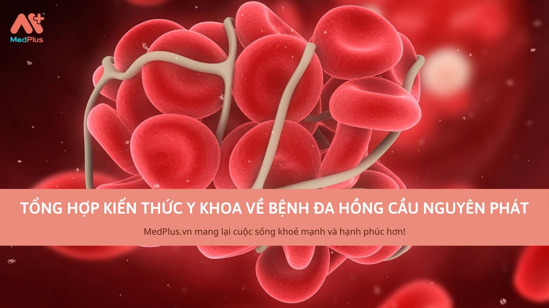 "Tổng