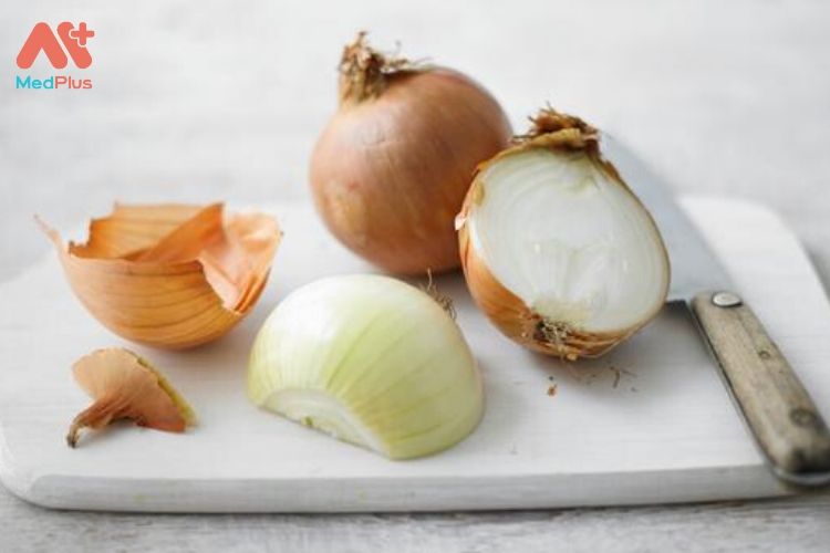 Bà bầu có ăn được hành tây không: 5 lợi ích bất ngờ từ hành tây 131 Bà bầu có ăn được hành tây không: 5 lợi ích bất ngờ từ hành tây