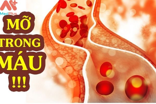 Top 5 địa chỉ điều trị mỡ trong máu uy tín huyện Nhà Bè