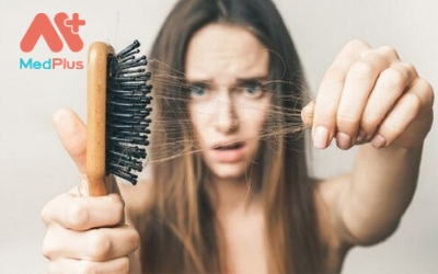 Bật mí Top 3 cơ sở trị rụng tóc hàng đầu Bình Chánh