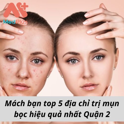 Mách bạn top 5 địa chỉ trị mụn bọc hiệu quả nhất Quận 2 137 Mách bạn top 5 địa chỉ trị mụn bọc hiệu quả nhất Quận 2