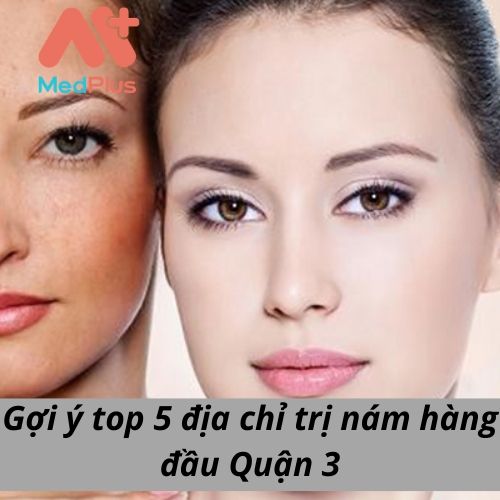Gợi ý top 5 địa chỉ trị nám hàng đầu Quận 3 128 Gợi ý top 5 địa chỉ trị nám hàng đầu Quận 3