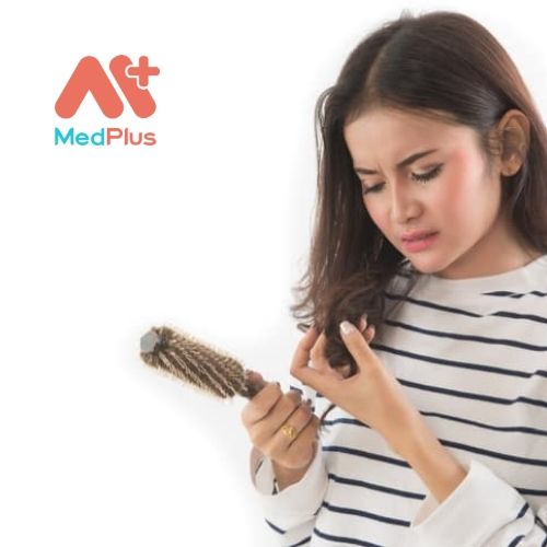 Bật mí top 5 địa chỉ khám rụng tóc hàng đầu Quận 2