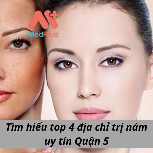 Tìm hiểu top 4 địa chỉ trị nám uy tín Quận 5