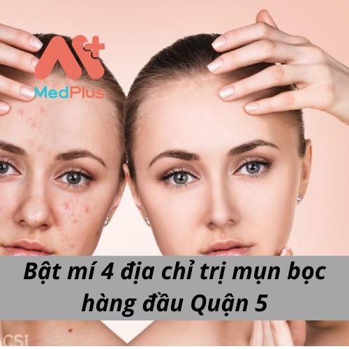 Bật mí 4 địa chỉ trị mụn bọc hàng đầu Quận 5