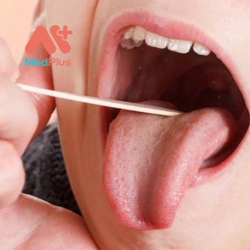 Tổng hợp Top 5 địa chỉ khám Amidan hàng đầu Quận 4 127 Top 5 phòng khám Amidan hàng đầu Quận Gò Vấp