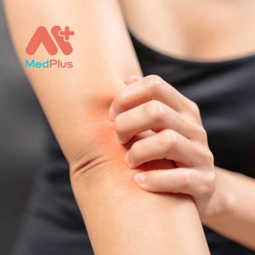 Danh sách Top 5 địa chỉ điều trị vảy nến uy tín Quận 10 127 Danh sách Top 5 địa chỉ điều trị vảy nến uy tín Quận 10