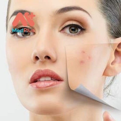 Top 5 địa chỉ điều trị mụn trứng cá hàng đầu Quận Bình Tân 137 Tìm hiểu 4 địa chỉ điều trị mụn trứng cá uy tín Quận Gò Vấp