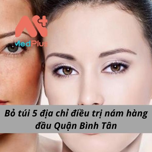 Phòng khám Da liễu quận Bình Tân – BS. Nguyễn Thành Hy – điều trị nám uy tín Quận Bình Tân 1 - Medplus