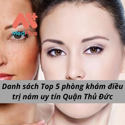 Danh sách Top 5 phòng khám điều trị nám uy tín Quận Thủ Đức