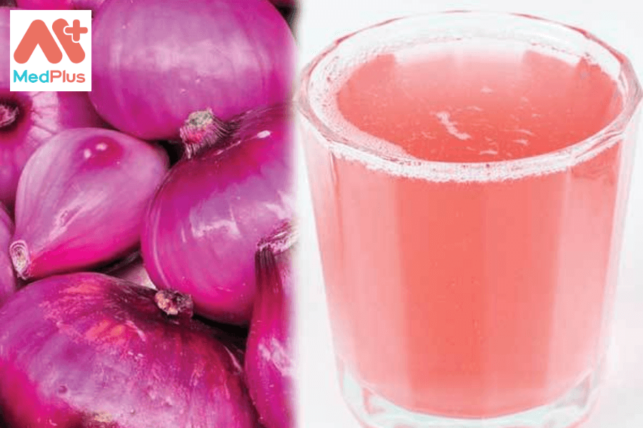 Lợi ích của nước ép hành tây