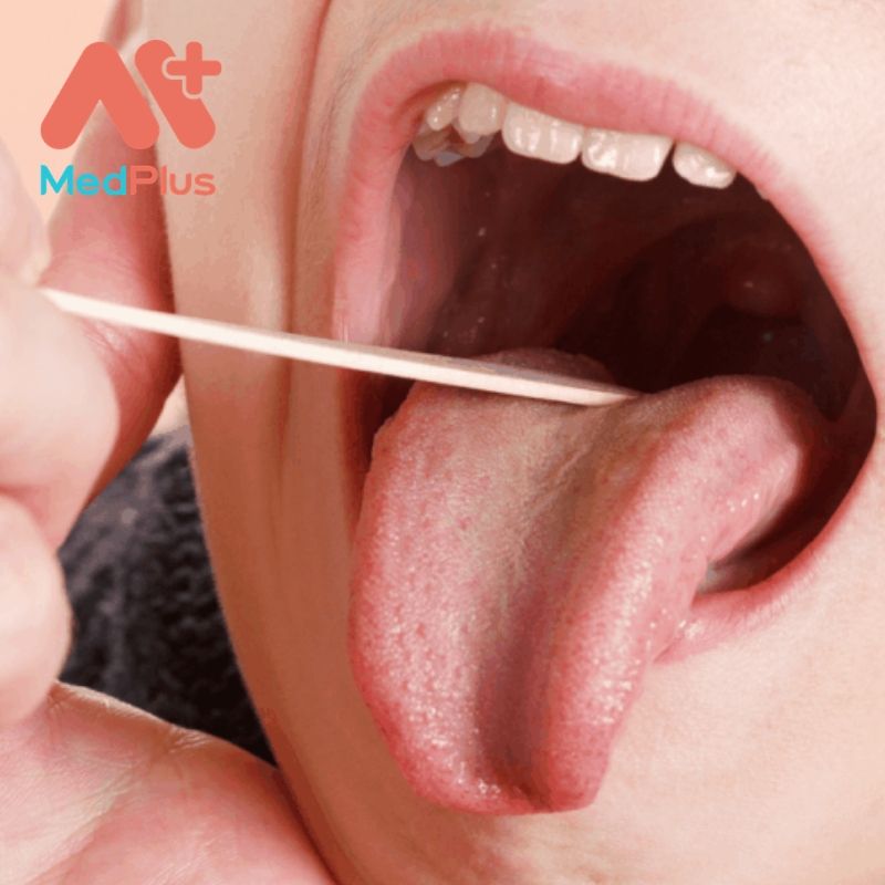 Địa chỉ khám viêm họng cho bé uy tín TPHCM