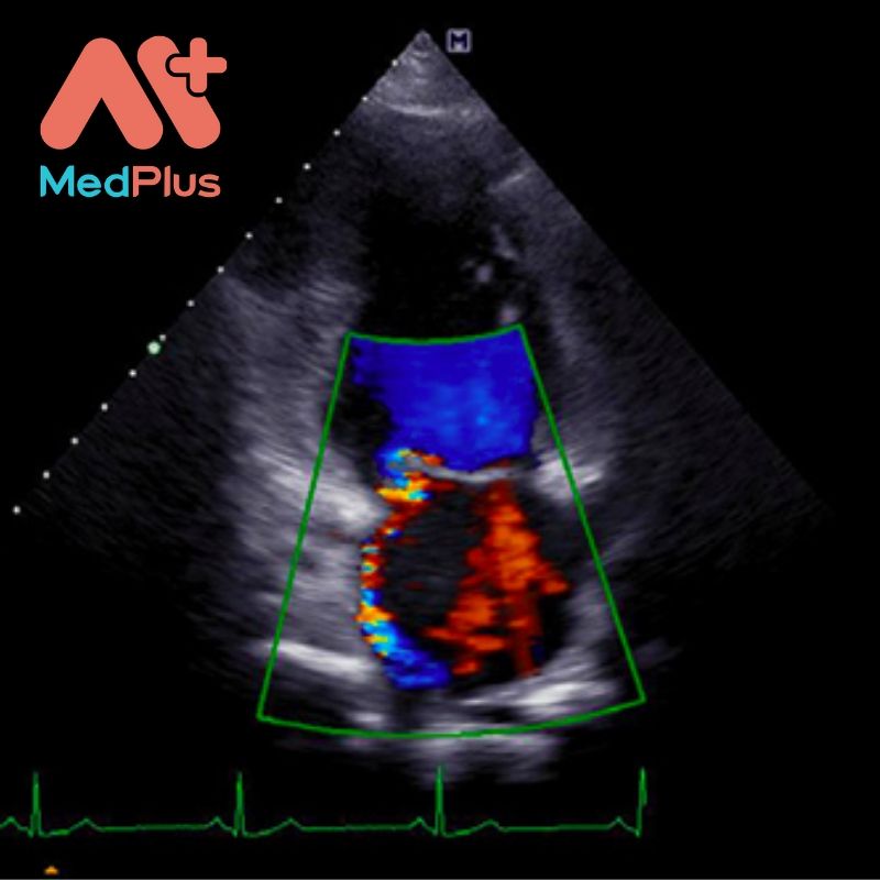 Địa chỉ siêu âm doppler uy tín quận 8