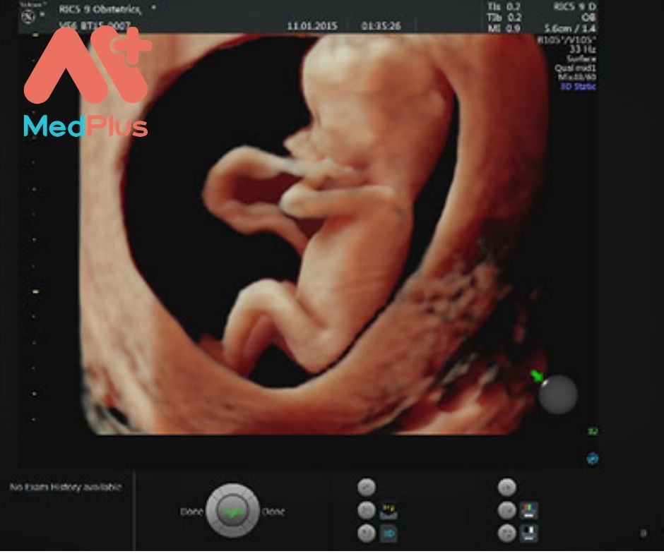 Top 5 địa chỉ siêu âm doppler uy tín quận Gò Vấp 141 Địa chỉ siêu âm doppler uy tín quận Gò Vấp