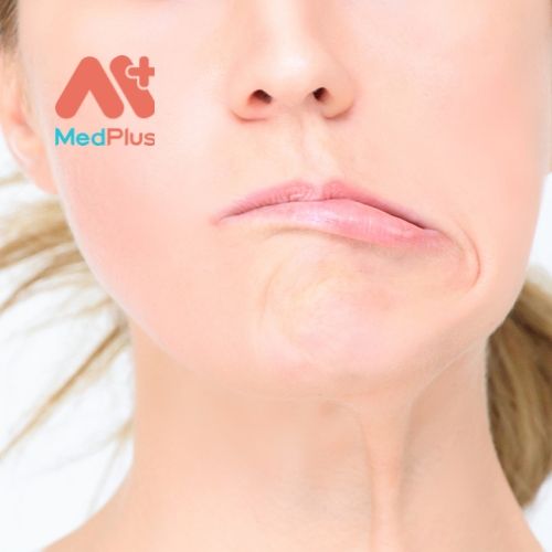 Tìm hiểu Top 5 địa chỉ khám liệt dây 7 hàng đầu Quận 5