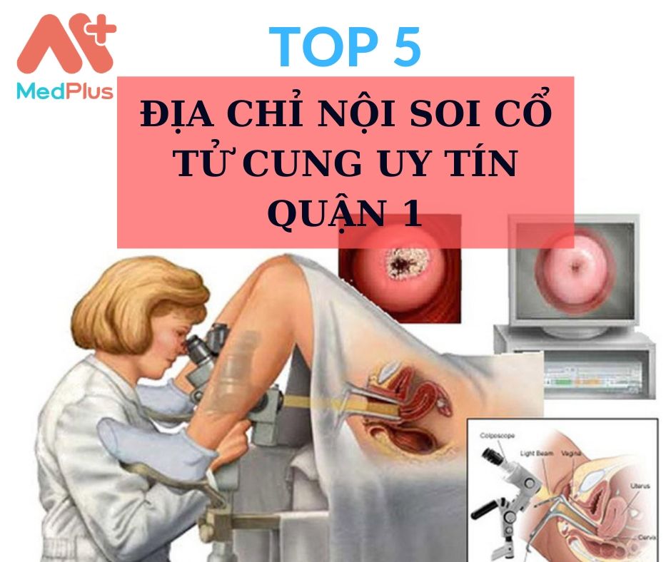 Nội soi cổ tử cung quận 1